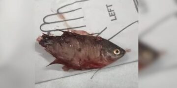 Boy died due to fish