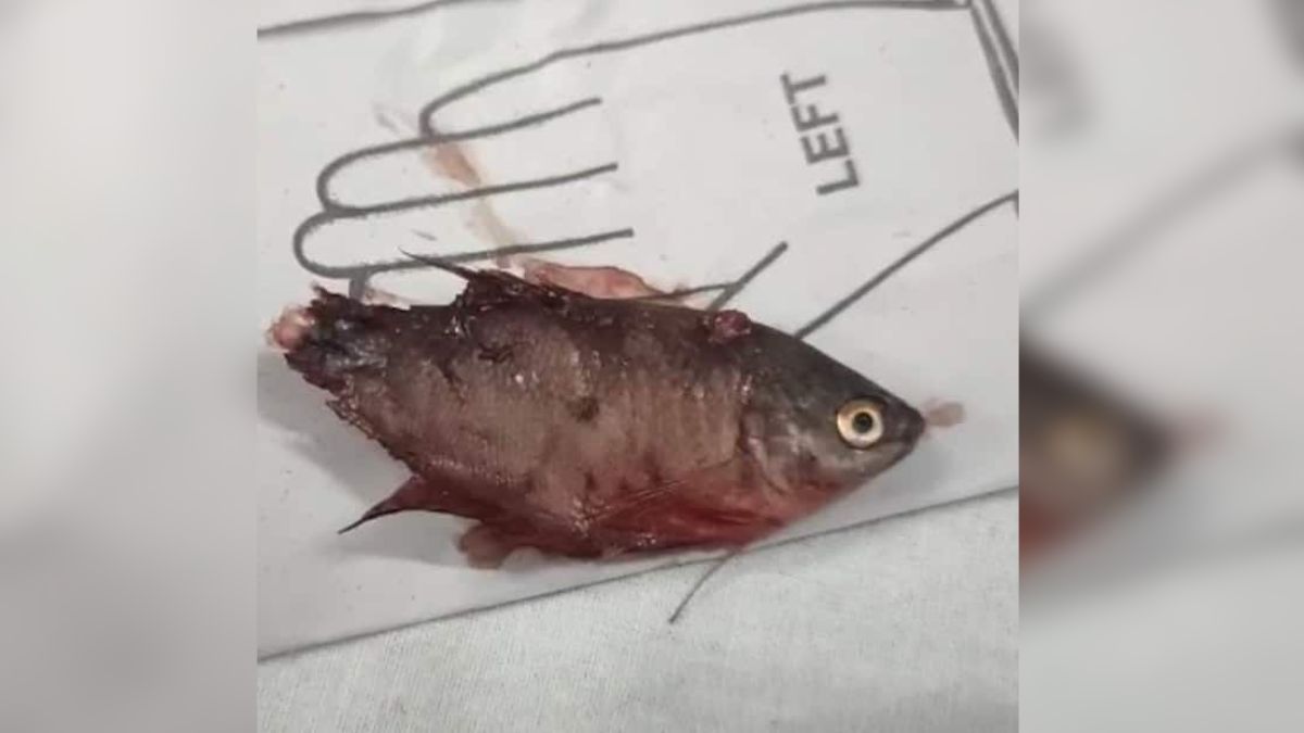 Boy died due to fish